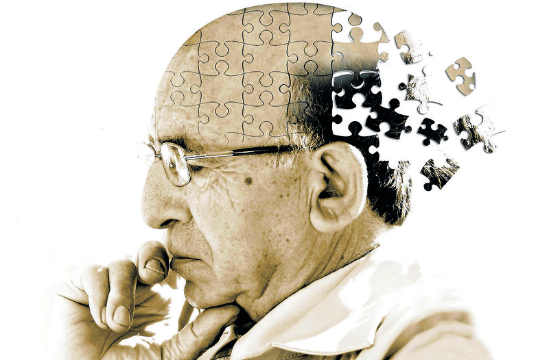 Bệnh Alzheimer là gì & Cách khắc phục, điều bệnh như thế nào? 5